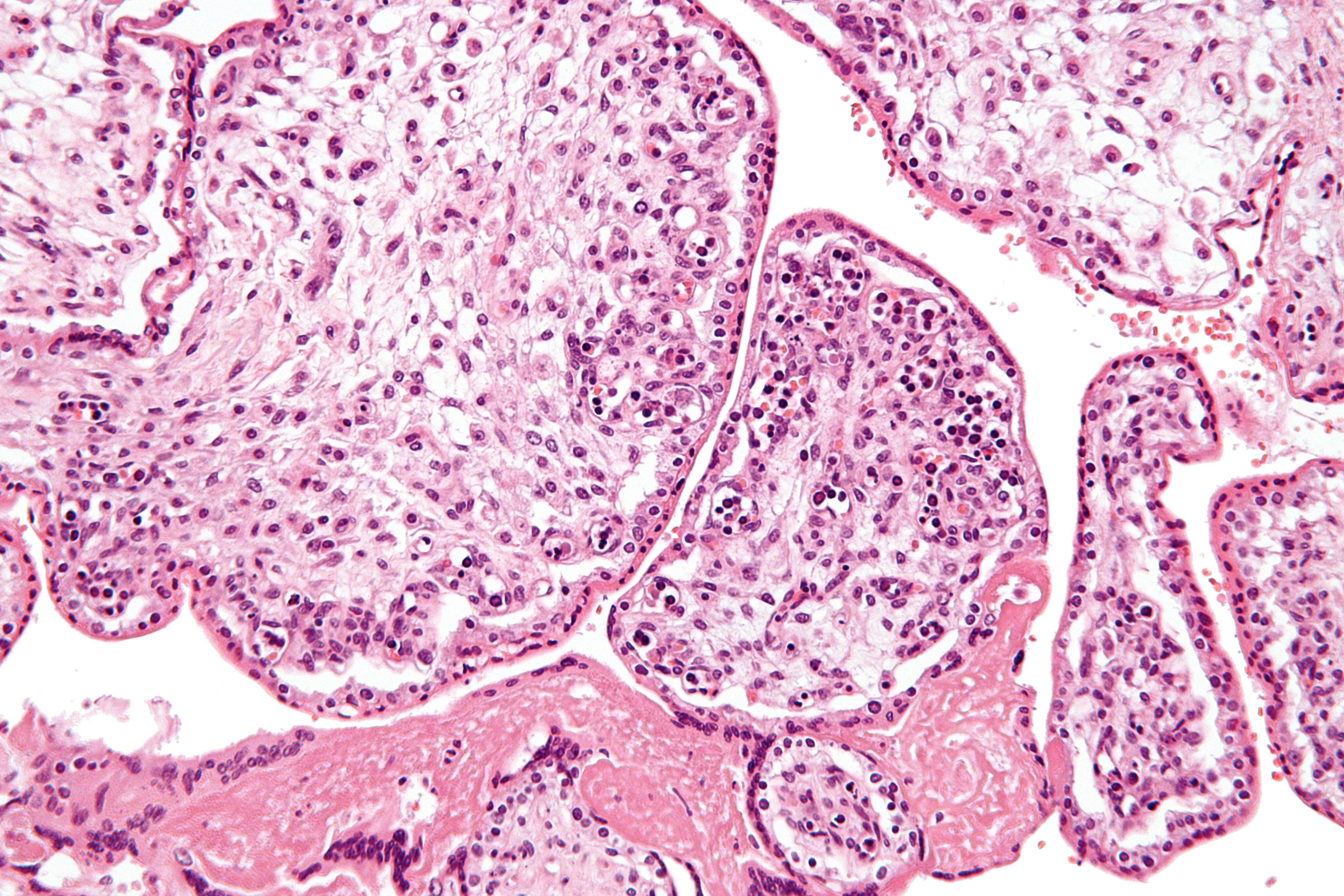 Microscopic view of pink and purple stained placental villi tissue.